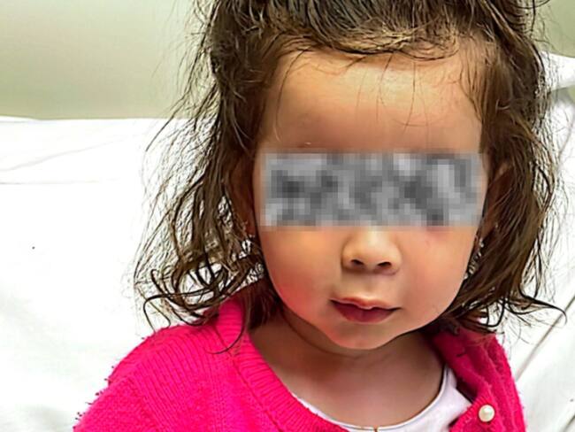 Soluciones W: La Dra. Bonna recuperará la sonrisa de la pequeña Anthonella