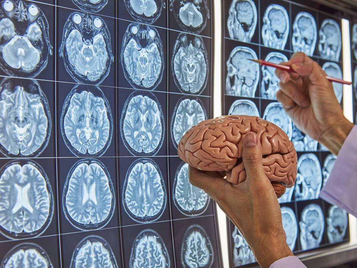 ¿Qué tan riesgosas son las cirugías cerebrales? Experto desmintió mitos