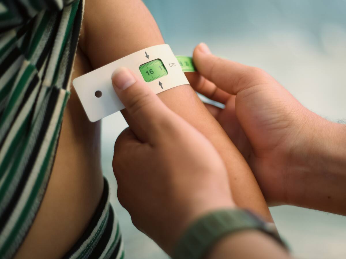 ¿Cómo afecta la desnutrición crónica a los niños? Experto explicó