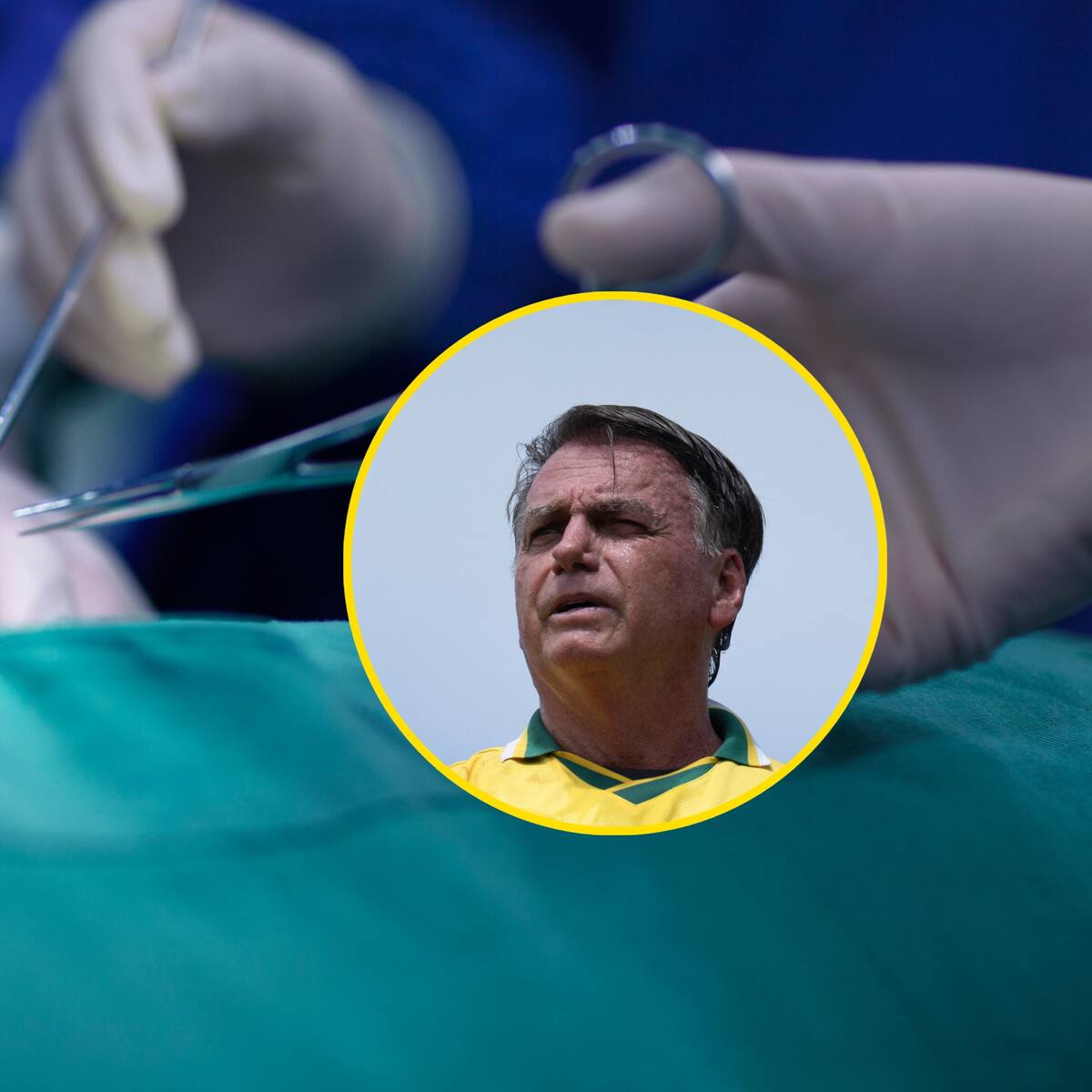 Jair Bolsonaro ha sido sometido a una operación en Brasil por una oclusión intestinal