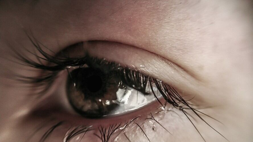 La joven que es alérgica a sus propias lágrimas. Foto: Getty Images