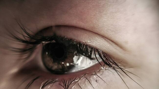 La joven que es alérgica a sus propias lágrimas. Foto: Getty Images