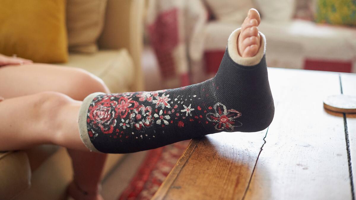 ¿Cuáles son los cuidados de un niño cuando sufre una fractura? Ortopedista dio detalles