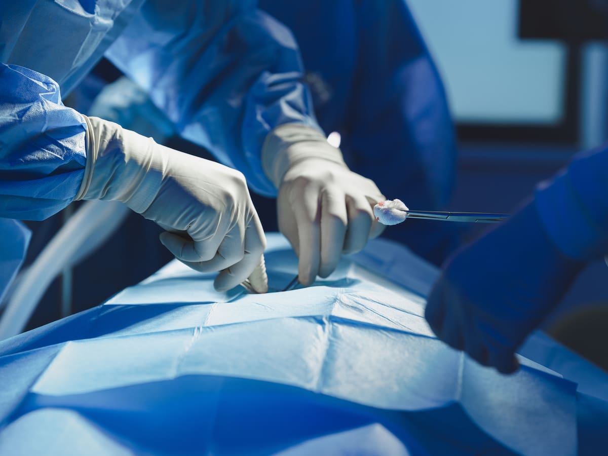 Los mitos y verdades de la faloplastia