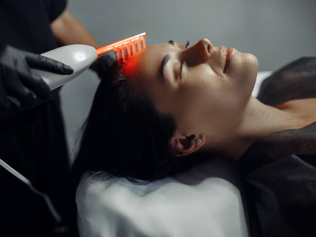 ¿Qué es y para qué sirve la mesoterapia capilar?