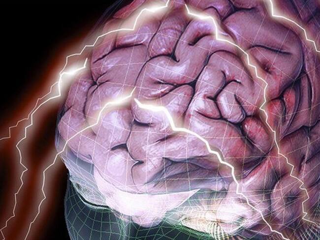 ¿Puede la forma de tu cerebro afectar rasgos de tu personalidad?. Foto: BBC Mundo