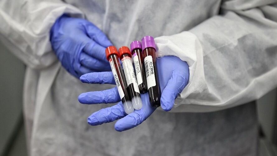 Pruebas COVID-19. Foto: Colprensa