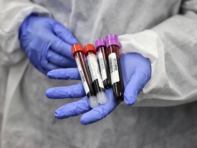 Pruebas COVID-19. Foto: Colprensa