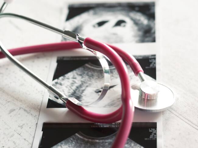 Creo que se le fue la mano a la Corte sobre la semana 24: experto sobre interrupción voluntaria del embarazo