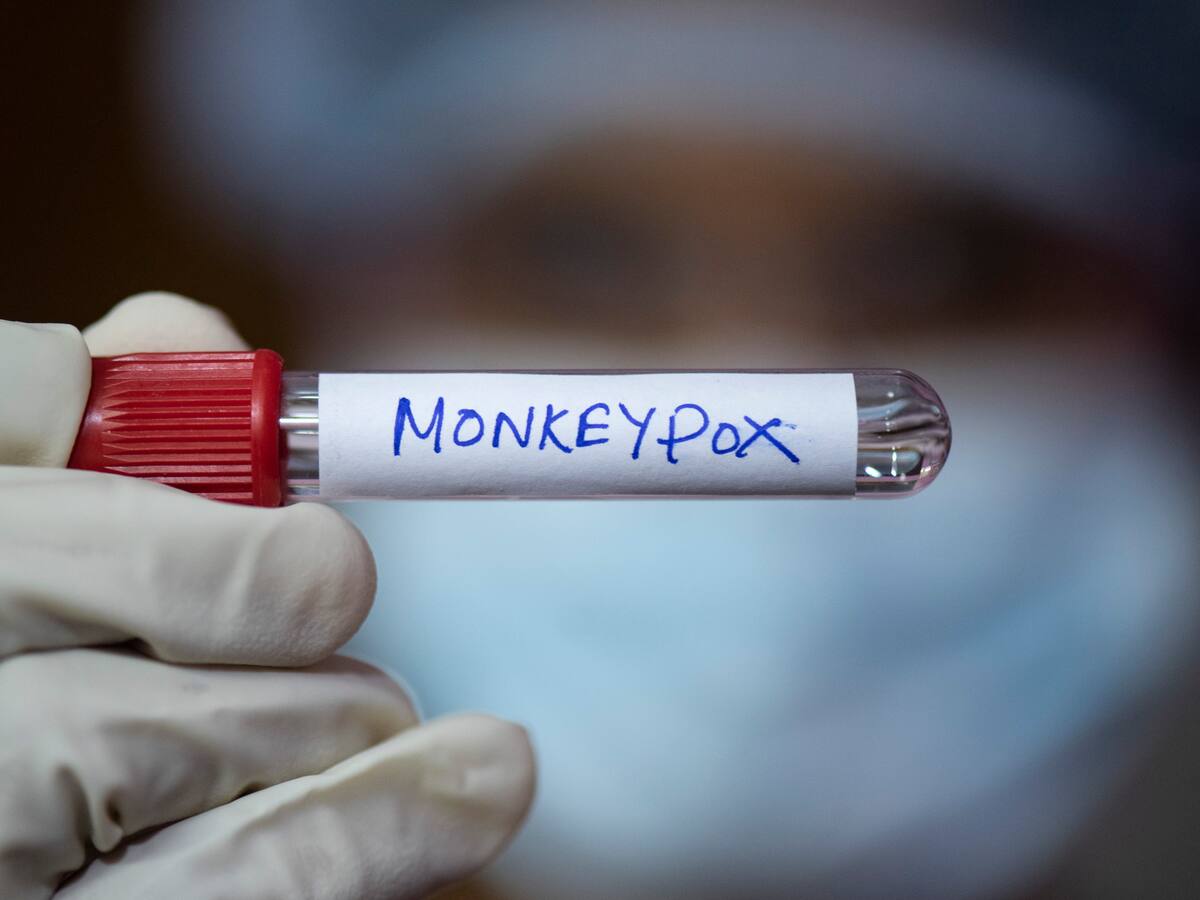 Mpox o viruela del mono, ¿cómo se contagia y cuáles son sus síntomas?