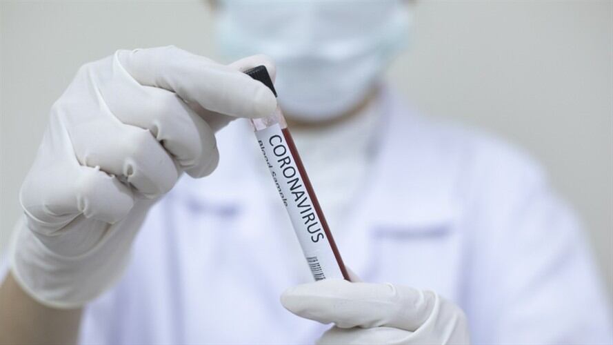 Desde que se suspendió la exigencia de la prueba han ingresado al país más de 283.000 viajeros, de los cuales más de 192.000 son colombianos.. Foto: Getty Images