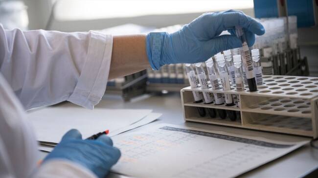 Científicos encuentran COVID-19 en semen de hombres infectados con el virus en China. Foto: Getty Images