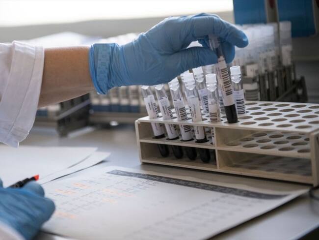 Científicos encuentran COVID-19 en semen de hombres infectados con el virus en China. Foto: Getty Images