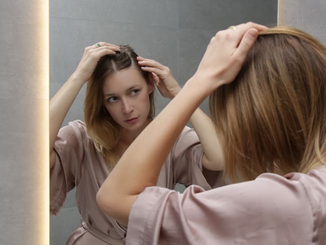 ¿La alopecia tiene cura? Experta habló