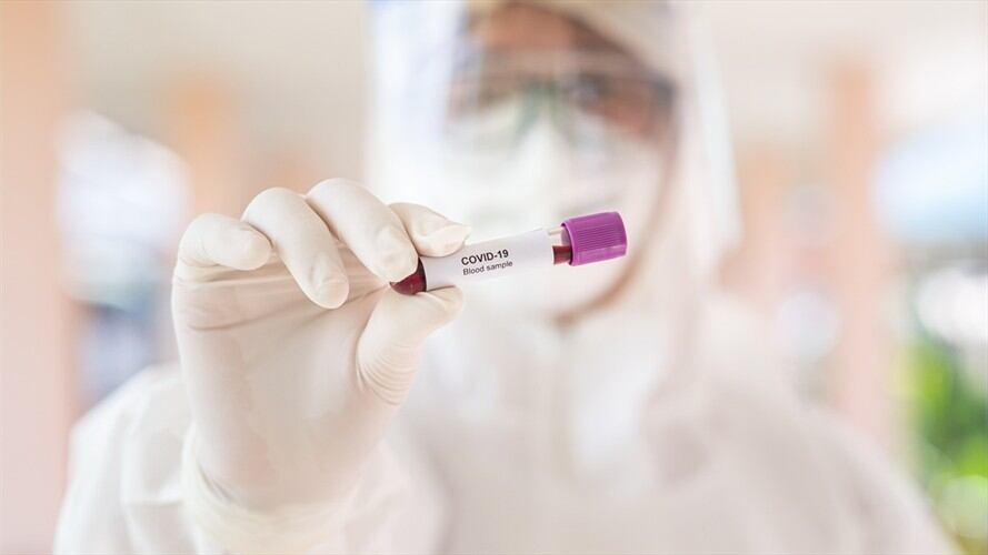 Los dermatólogos del hospital italiano Alessandro Manzoni, de Lombardía encontraron lo que parece ser otra forma de manifestarse del virus.. Foto: Getty Images