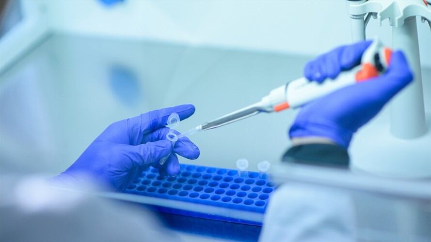 Casos de COVID-19 en Colombia. Foto: Getty Images