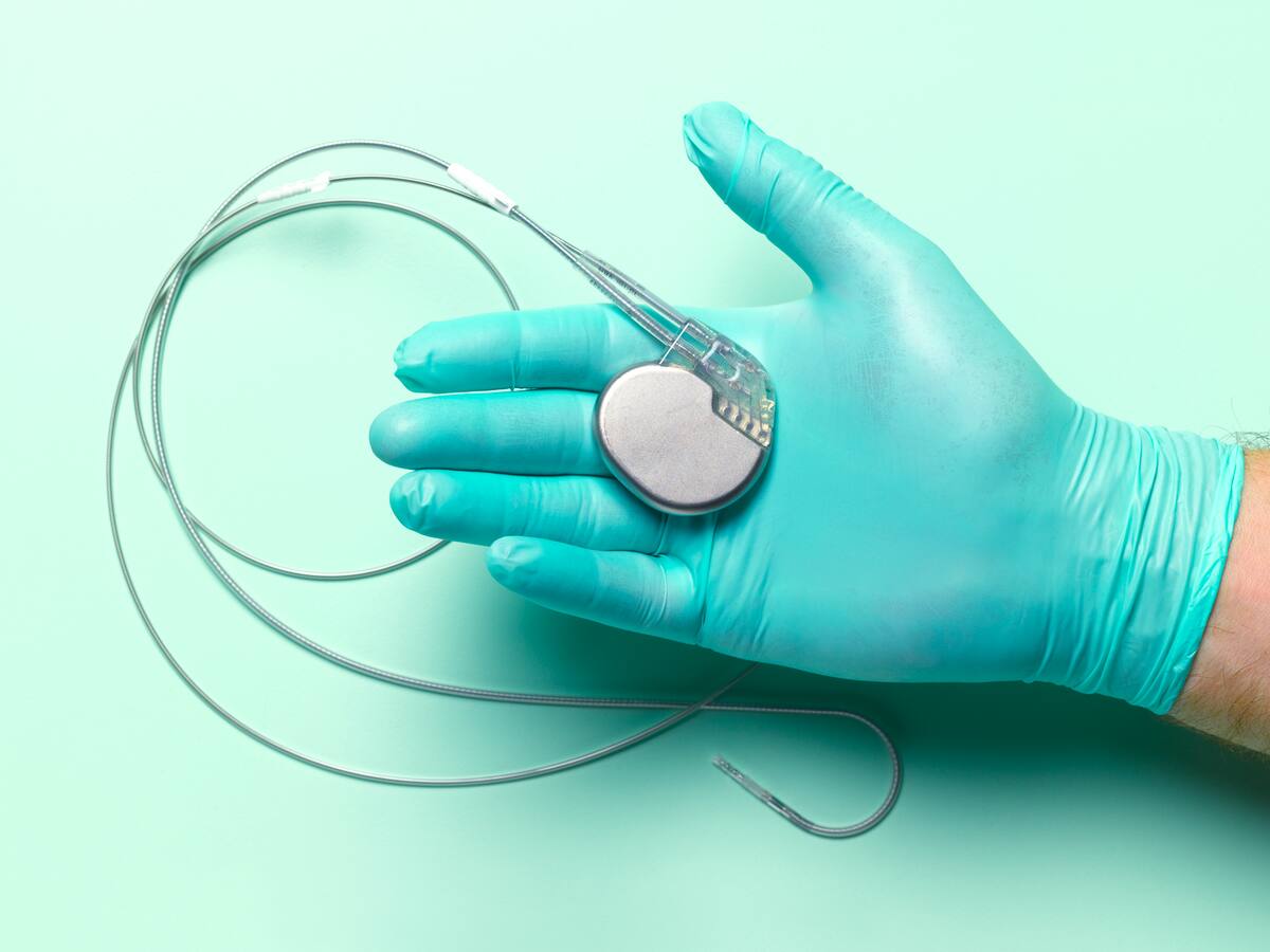 ¿Qué es y cómo funciona un marcapasos? Cardiólogo explica