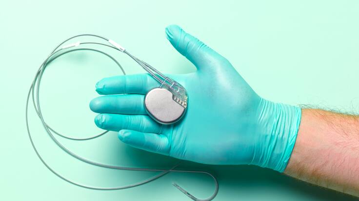 ¿Qué es y cómo funciona un marcapasos? Cardiólogo explica