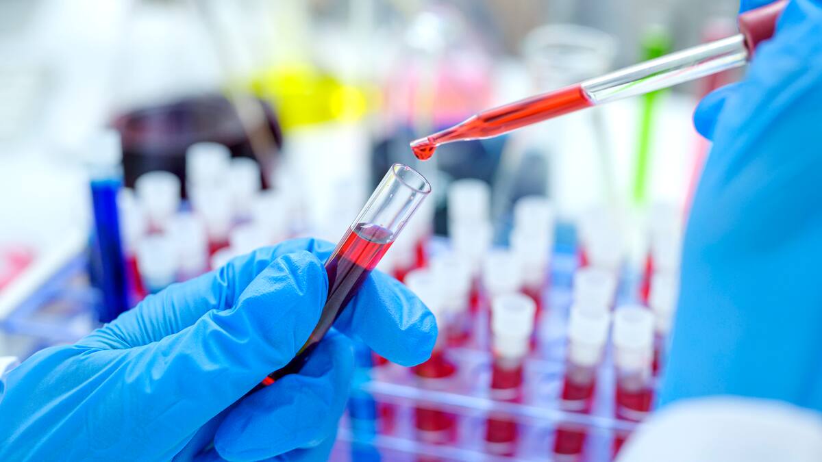 En Colombia cerca de 170.000 personas viven con VIH sin que lo sepan: infectólogo