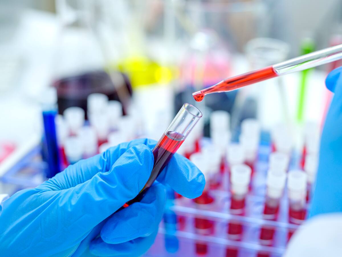 En Colombia cerca de 170.000 personas viven con VIH sin que lo sepan: infectólogo