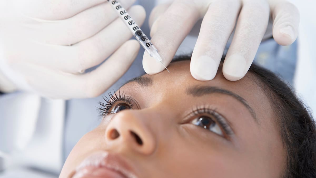 Bótox temprano para prevenir líneas de expresión: ¿qué dicen los expertos?