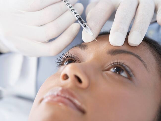 Bótox temprano para prevenir líneas de expresión: ¿qué dicen los expertos?