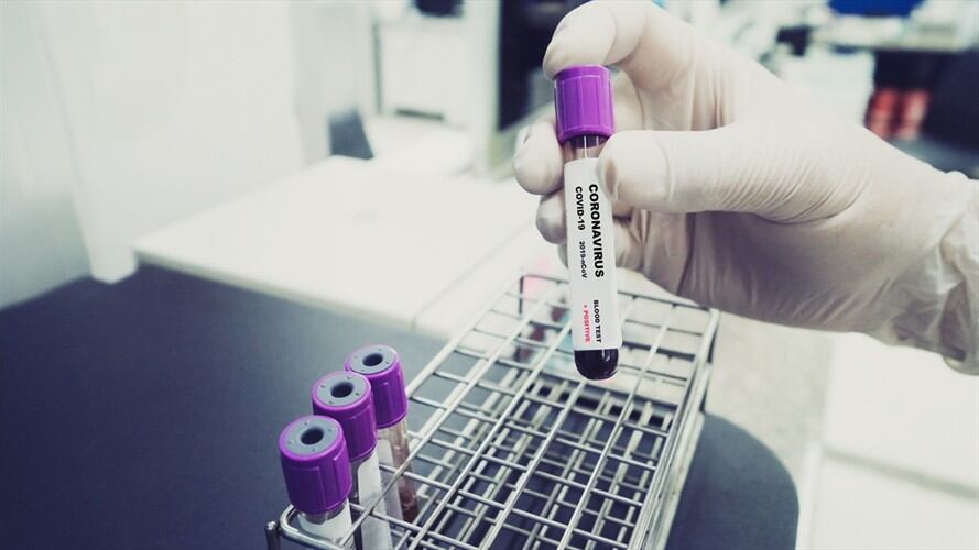 Casos de COVID-19 en Colombia. Foto: Getty Images