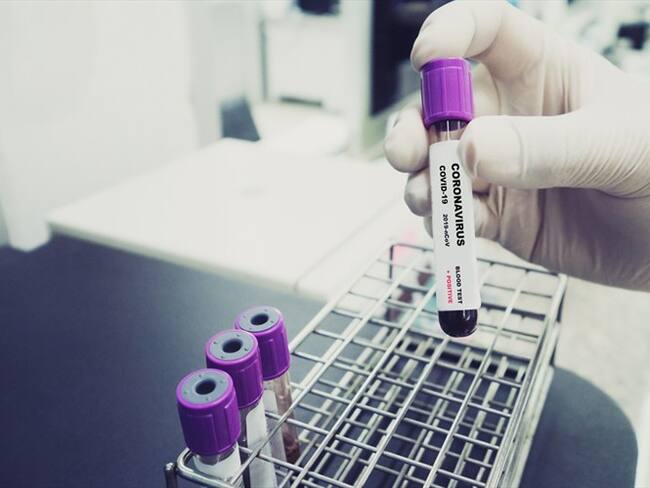 Casos de COVID-19 en Colombia. Foto: Getty Images