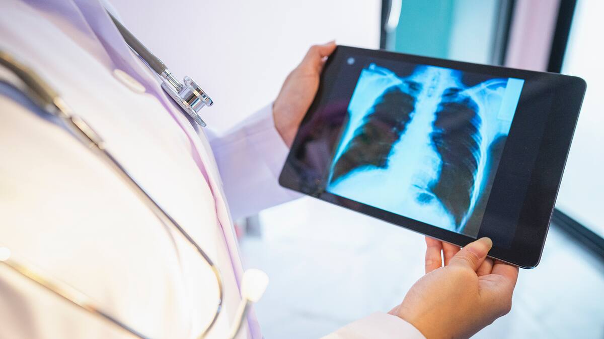 Día Mundial de la Lucha contra el Cáncer de Pulmón: ¿qué hacen las empresas?