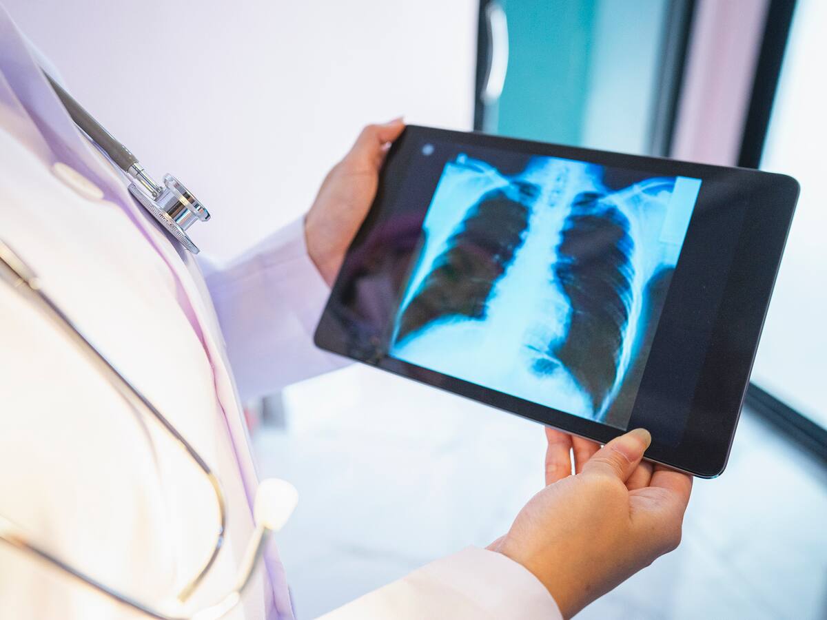 Día Mundial de la Lucha contra el Cáncer de Pulmón: ¿qué hacen las empresas?