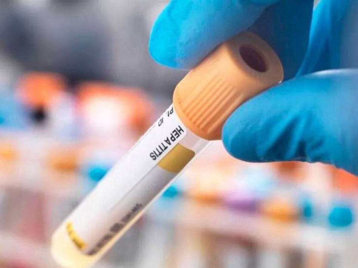 Investigan origen de brote de hepatitis A en Dagua, Valle del Cauca