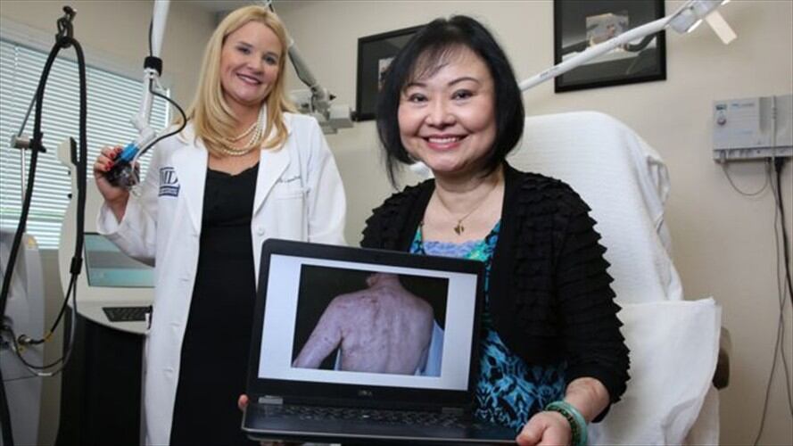 Kim Phuc. Foto: BBC Mundo