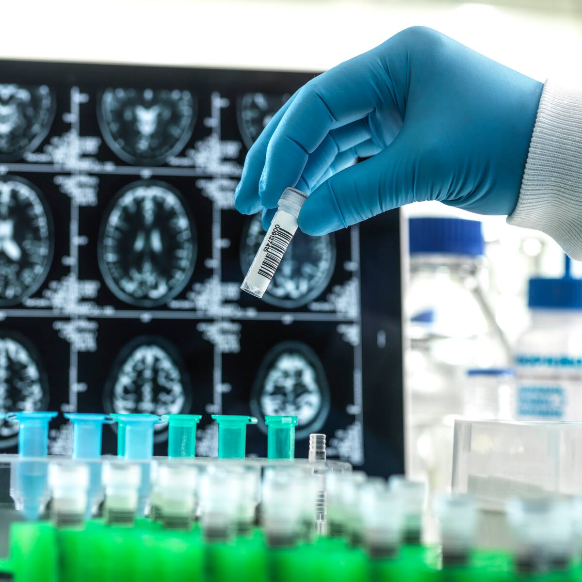 “Es un futuro prometedor para todos”: médico que usa células madre para la memoria