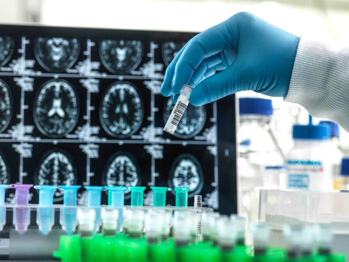 “Es un futuro prometedor para todos”: médico que usa células madre para la memoria