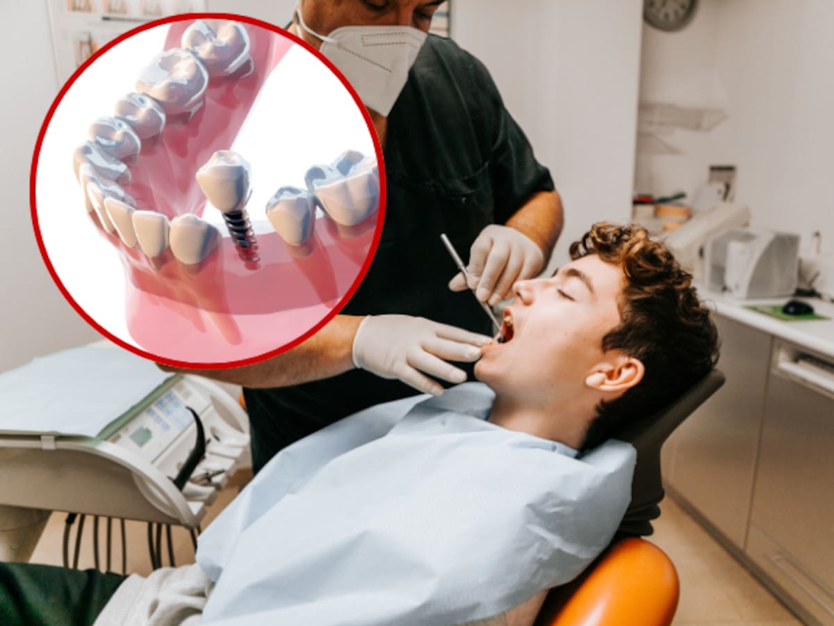 Tratamientos de odontología que cubre la EPS en 2026: ¿Incluye implantes dentales? Le contamos