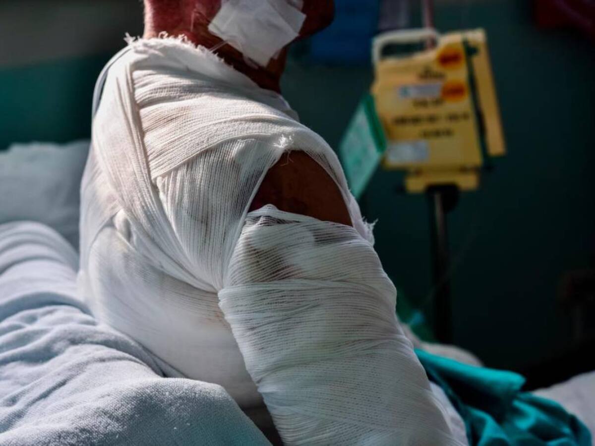 Dos quemados con pólvora deja las fiestas navideñas en el Magdalena