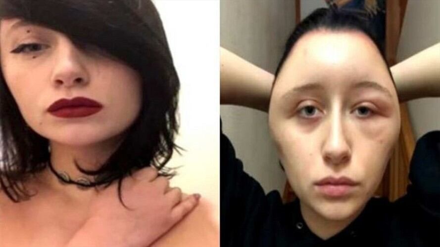 Al parecer la joven francesa no siguió las instrucciones del tinte y causó graves daños a su salud.. Foto: Cortesía