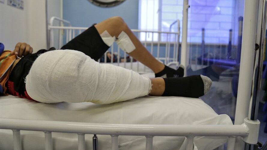 La ciudad de Popayán registra cuatro casos en lo corrido de diciembre y desde que se activó la vigilancia intensificada por pólvora. Foto: Colprensa