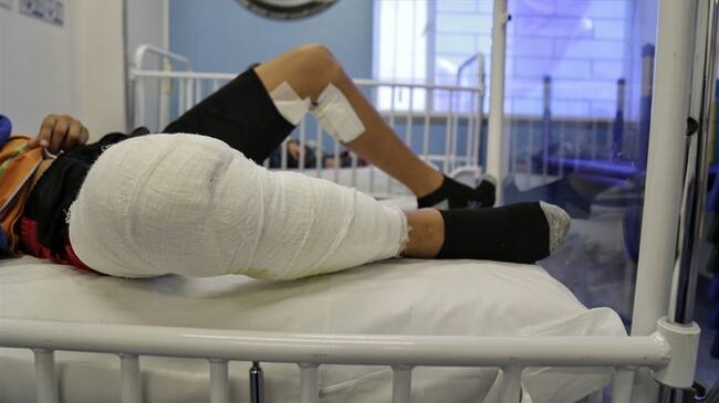 La ciudad de Popayán registra cuatro casos en lo corrido de diciembre y desde que se activó la vigilancia intensificada por pólvora. Foto: Colprensa