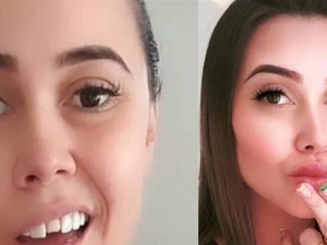 Por ganar dinero, odontólogos ofrecen diseños de sonrisa que no saben hacer: Quintana