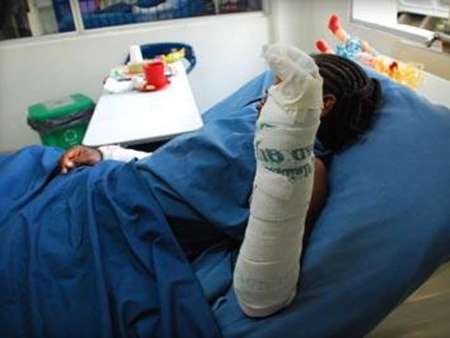 17 de los lesionados son menores de edad entre los 3 y los 16 años. Crédito: Colprensa.