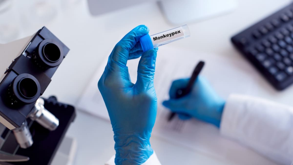 Colombia no iniciará vacunación masiva contra la viruela símica, por recomendación de OPS