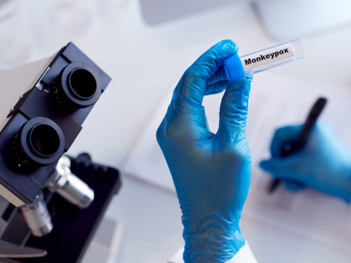 Colombia no iniciará vacunación masiva contra la viruela símica por recomendación de OPS