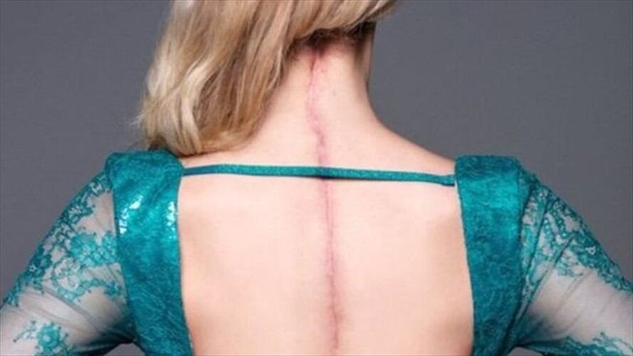 "Tengo una enfermedad invisible": la reina de belleza con el Síndrome de Ehlers-Danlos. Foto: BBC Mundo