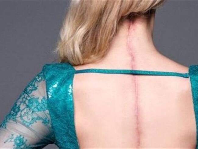 "Tengo una enfermedad invisible": la reina de belleza con el Síndrome de Ehlers-Danlos. Foto: BBC Mundo