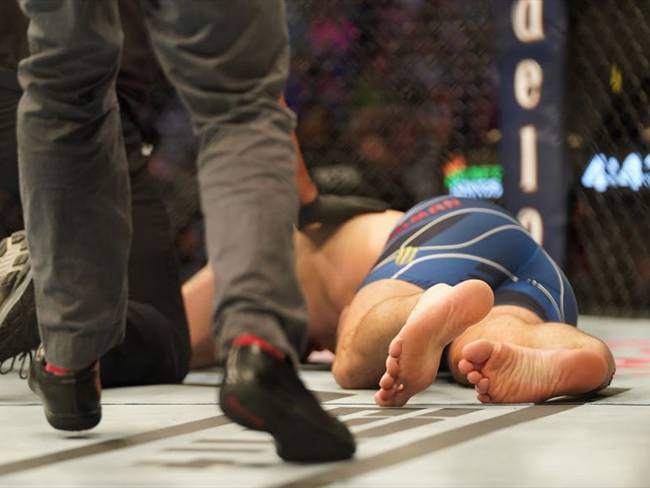 La impactante lesión de Chris Weidman en el UFC. Foto: Getty Images